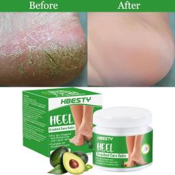 Avocado Heel Crack Repair Cream Anti-Drying Anti-Cracking Treatment Remove Dead Skin Moisturizing Nourishing Hand Feet Oil Care