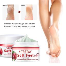 Antifreeze And Anti-cracking Foot Cream Moisturizing Repairing Dry Skin,Anti-Peeling Rough And Cracked Hands Feet Products Care