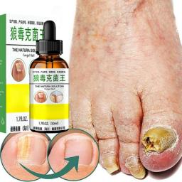 Treatment Fungal Nail Essence Serum Care Repair Foot Nail Fungus Removal Gel Anti Infection Paronychia Onychomycosis Product