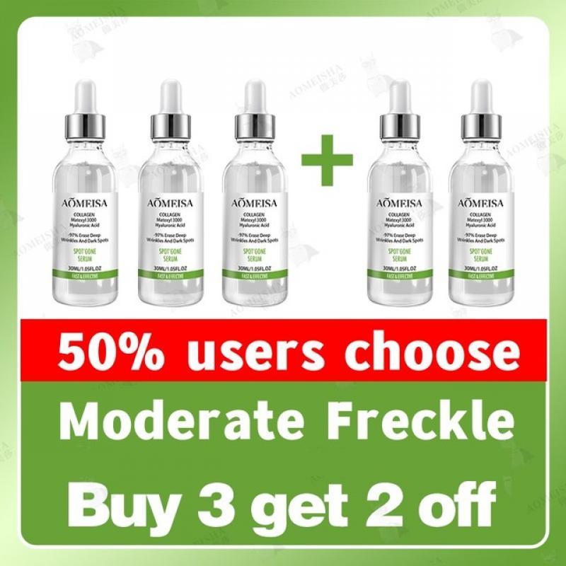 Freckles Removal Essence Remove Facial Spots Skin Dark Spot Remove Melasma Spots Sunspots Whitening And Freckle Removing Cream