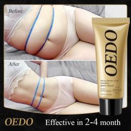 Slimming Cream Burn Fat Quickly Efficiently Lose Weight Gentle Safe No ReboundBody Shaping Waist Thigh Hand Slimming Body Care