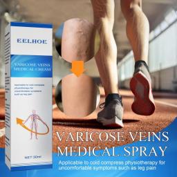 Varicose Vein Soothing Relief Spray Treatment Vasculitis Phlebitis Spider Pain Leg Swelling Medical Ointment Body Care Products
