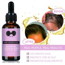 Soften Scalp Repair Damaged Hair Growth Essential Oils Essence Care Products Hair Loss Restore Dense Hair Thicker Liquid Serum