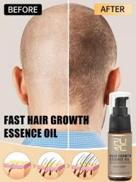 PURC Hair Growth Oil For Men Women Anti Hair Loss Scalp Treatment Serum Ginger 7 Day Fast Regrowth Care Hair Growth Products