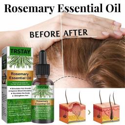 Hair Growth Oil Rosemary Essential Oil Anti-frizz Anti Hair Loss Hairs Smooth Serum Hairs Care Hairs Loss Treatments New Fashion