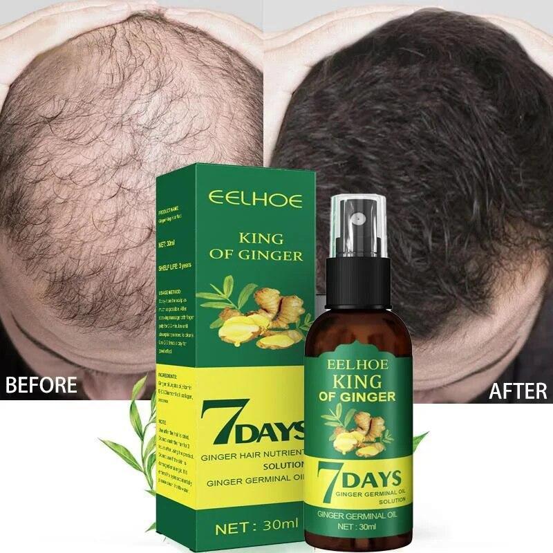 5/15/30/50ml Hair Growth Essential Oil Products Effective Fast Growing Serum Prevent Hair Loss Scalp Treatment for Men Women