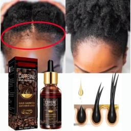 Alopecia Hair Treatment For Women Hairloss Hair Oil Growth Tool Spray Caffeine For Treatment Dry Frizzy Damaged Thin Hair Care