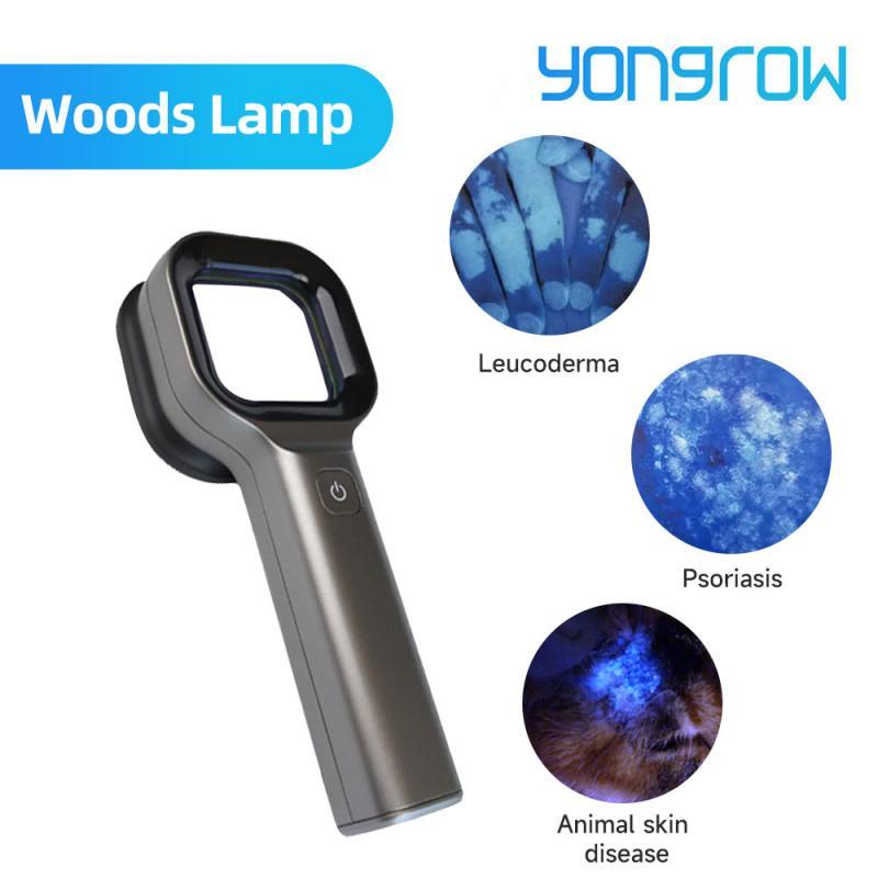 Yongrow Medical Woods Lamp Skin Examination Skin Fungus Detector Vitiligo Pityriasis Versicolor Melasma Detector Woods Light