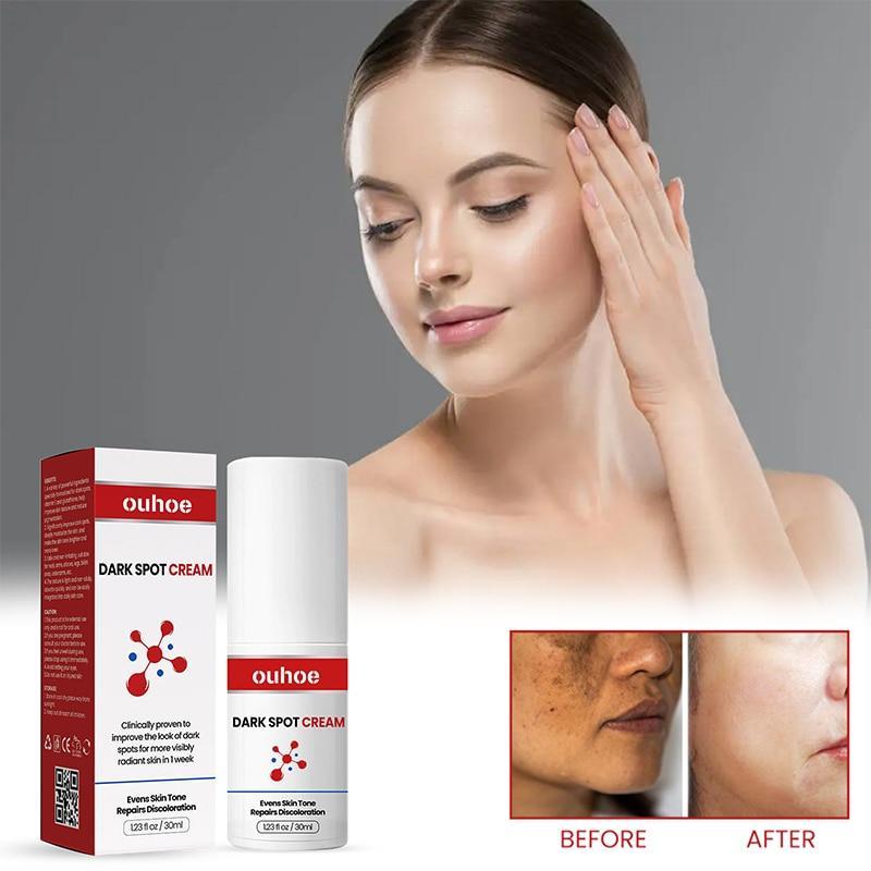 Effective Dark Spots Remover Cream Whitening Body Lotion Brighten Skin Repair Dull Lightening Fine Lines Pigment Skin Care Serum