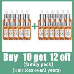 Fast Hair Growth Hair Follicle Treatment Hair Growth Seborrheic Alopecia Hairline Upward Postpartum Hair Loss Baldness Hair Loss