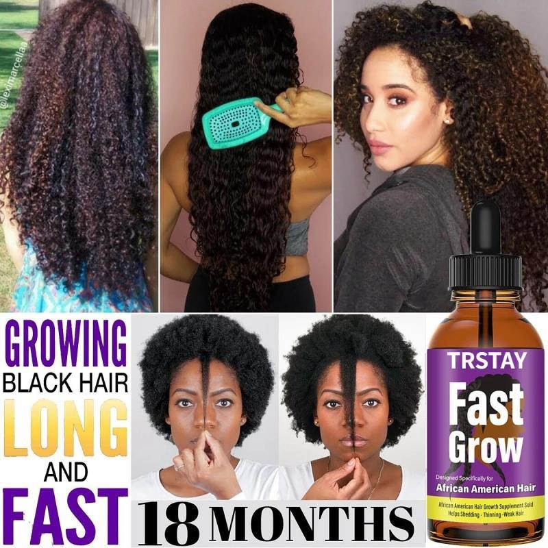 Anti Alopecia Oil Hair Growth Essential Oils for Black Women Essence Anti-Hair Loss Hair Serum for Thinning Hair Thickening