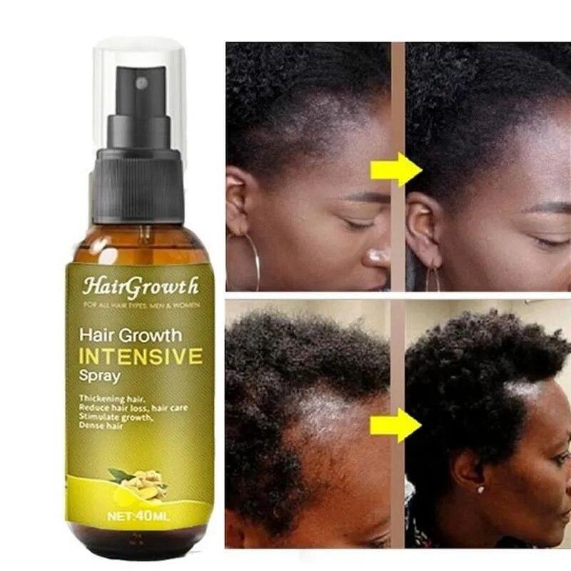 Ginger Hair Growth Essence Oils Products Anti Hair Loss Treatement Fast Growing Germinal Serum Prevent Scalp Damaged Men Women