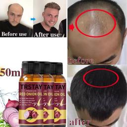 Natural Onion Hair Care Essential Oil Spray Beauty Care Scalp Rapid Hair Growth Anti-dry Frizz Improve Hair Quality