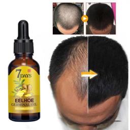 Hair Growth Serum Fast Growing Hair Essential Oil Beauty Hair Care 10/20/40ml Dense Regrowth Ginger Hair Promoting Regeneration