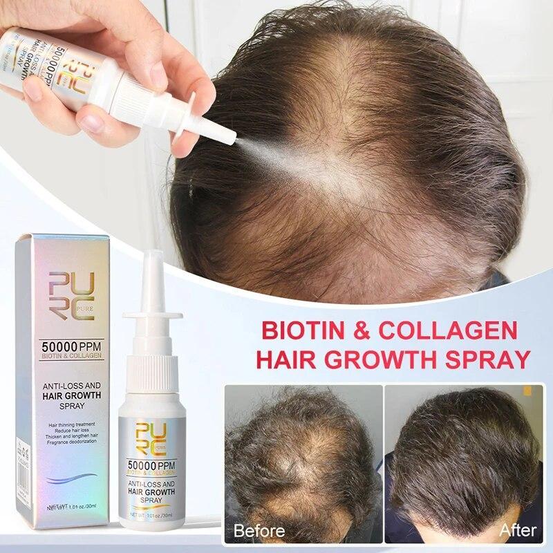 PURC Biotin Hair Growth Products for Men Women Hair Loss Treatment Fast Grow Hair Spray Regrowth Thicken Oil Hair Care