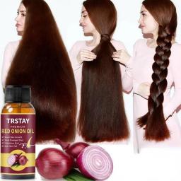 Hair Grouth Fast Onion Black Seed Essential Oils Oil Spray For Hair Care And Growth To Prevent Hair Loss